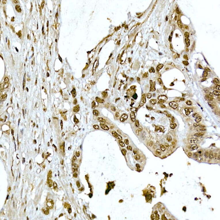Immunohistochemistry - Anti-AKT1 Antibody (A80442) - Antibodies.com
