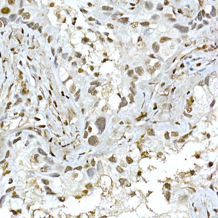 Immunohistochemistry - Anti-AKT1 Antibody (A80442) - Antibodies.com