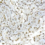 Immunohistochemistry - Anti-AKT1 Antibody (A80442) - Antibodies.com
