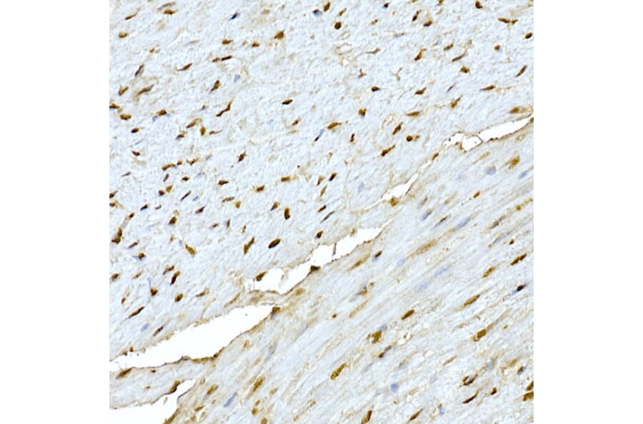 Immunohistochemistry - Anti-AKT1 Antibody (A80442) - Antibodies.com