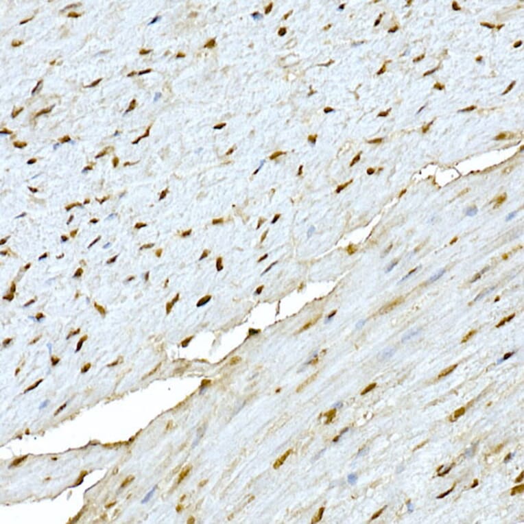 Immunohistochemistry - Anti-AKT1 Antibody (A80442) - Antibodies.com