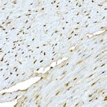 Immunohistochemistry - Anti-AKT1 Antibody (A80442) - Antibodies.com