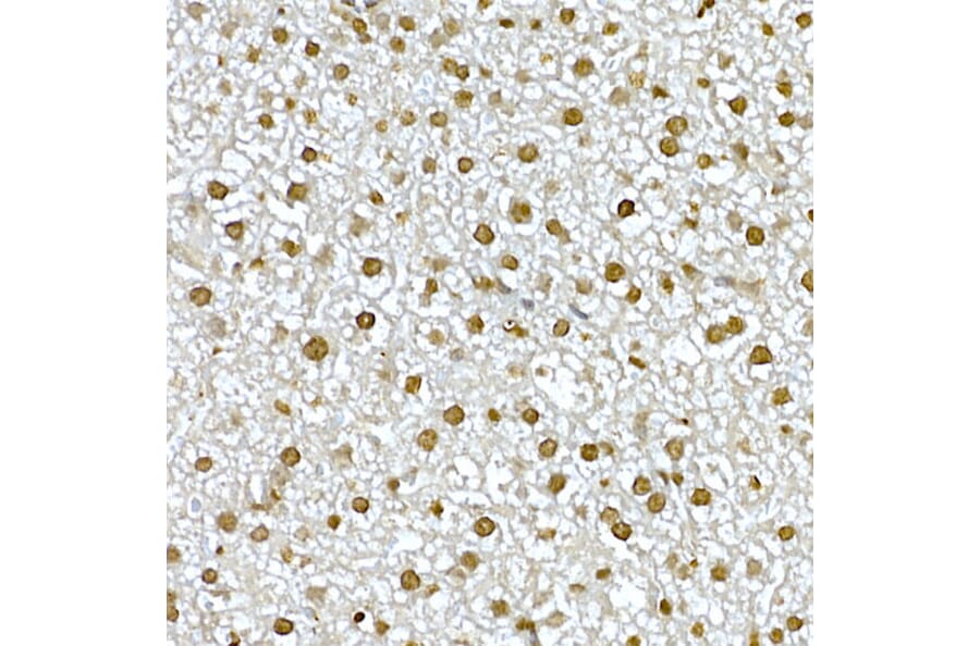 Immunohistochemistry - Anti-AKT1 Antibody (A80442) - Antibodies.com
