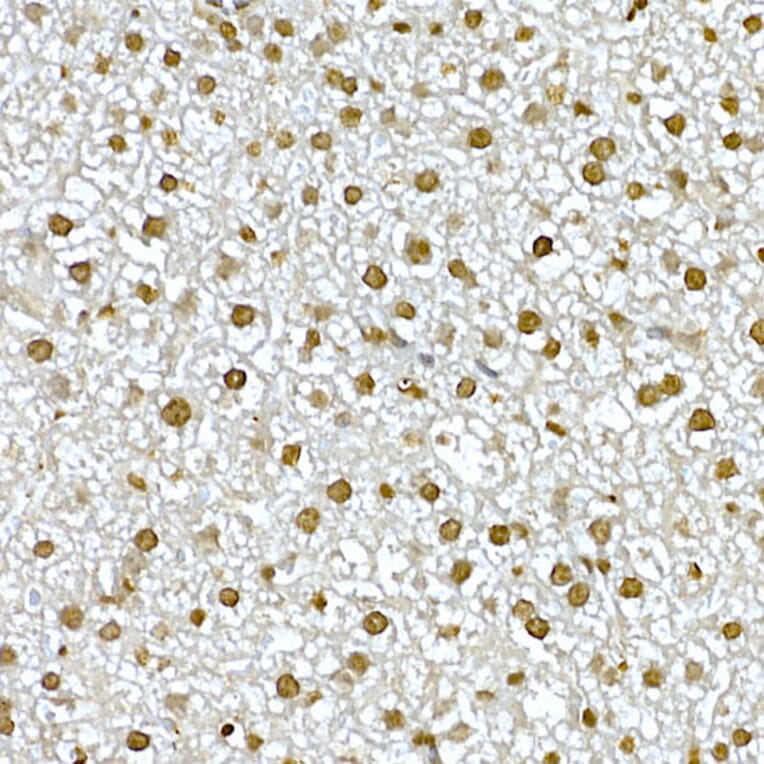 Immunohistochemistry - Anti-AKT1 Antibody (A80442) - Antibodies.com