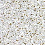 Immunohistochemistry - Anti-AKT1 Antibody (A80442) - Antibodies.com