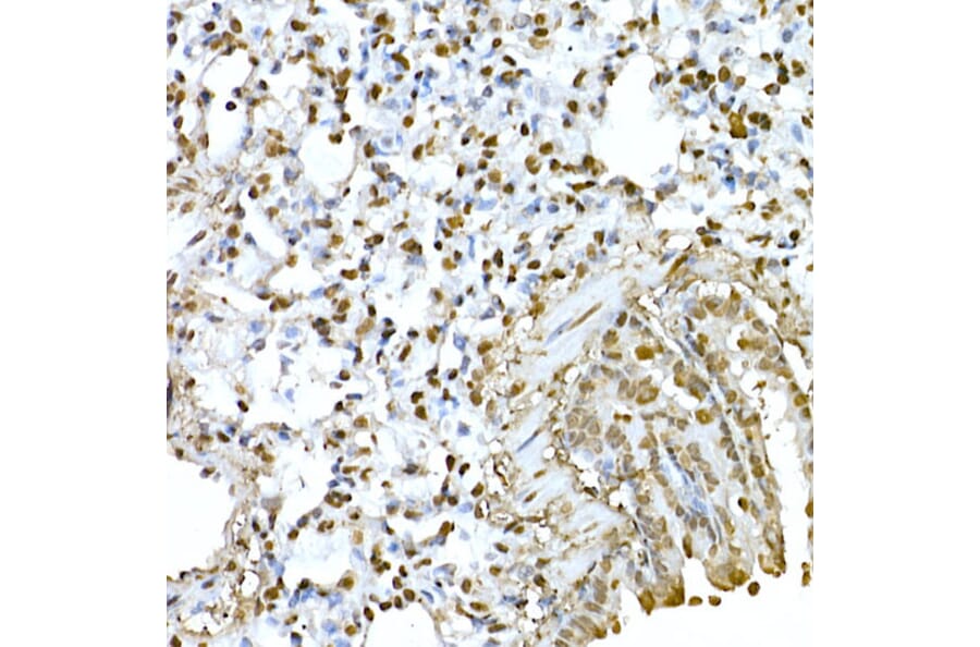 Immunohistochemistry - Anti-AKT1 Antibody (A80442) - Antibodies.com