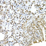 Immunohistochemistry - Anti-AKT1 Antibody (A80442) - Antibodies.com