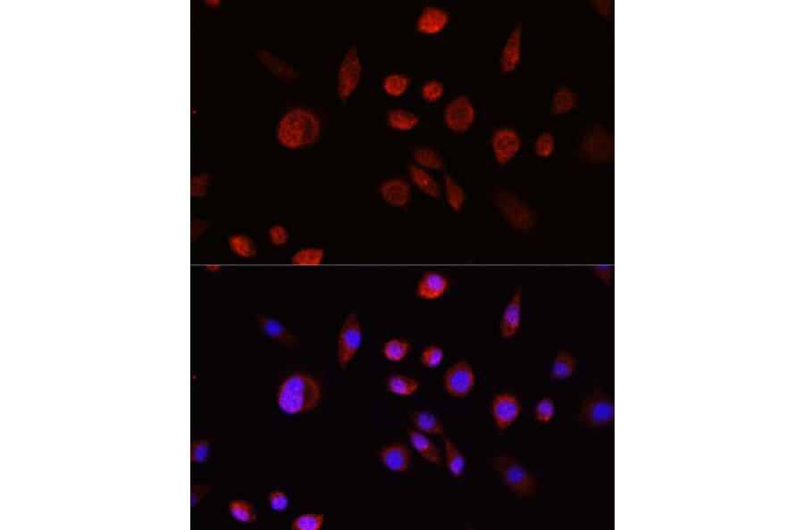Immunofluorescence - Anti-AKT1 Antibody (A80442) - Antibodies.com
