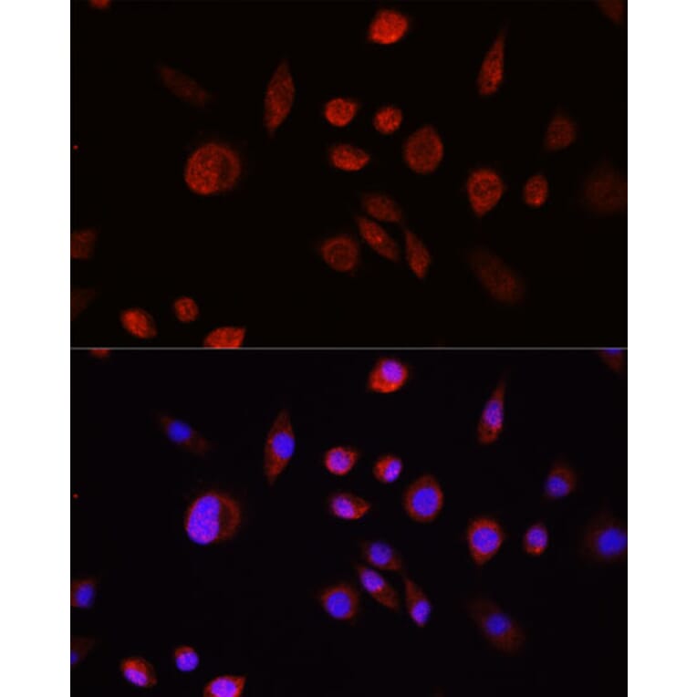 Immunofluorescence - Anti-AKT1 Antibody (A80442) - Antibodies.com