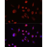 Immunofluorescence - Anti-AKT1 Antibody (A80442) - Antibodies.com