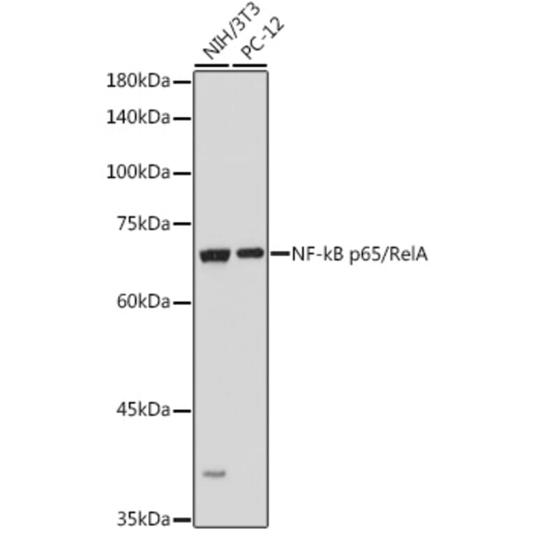 Western Blot - Anti-NF-kB p65 Antibody (A80443) - Antibodies.com