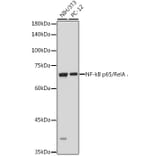 Western Blot - Anti-NF-kB p65 Antibody (A80443) - Antibodies.com