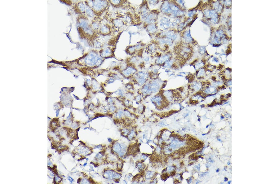 Immunohistochemistry - Anti-NF-kB p65 Antibody (A80443) - Antibodies.com