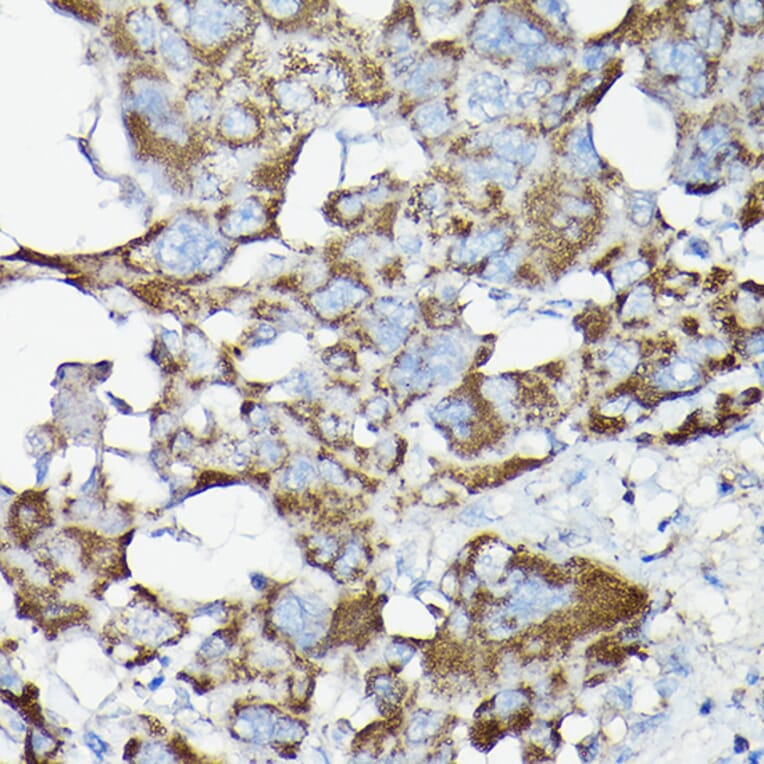 Immunohistochemistry - Anti-NF-kB p65 Antibody (A80443) - Antibodies.com