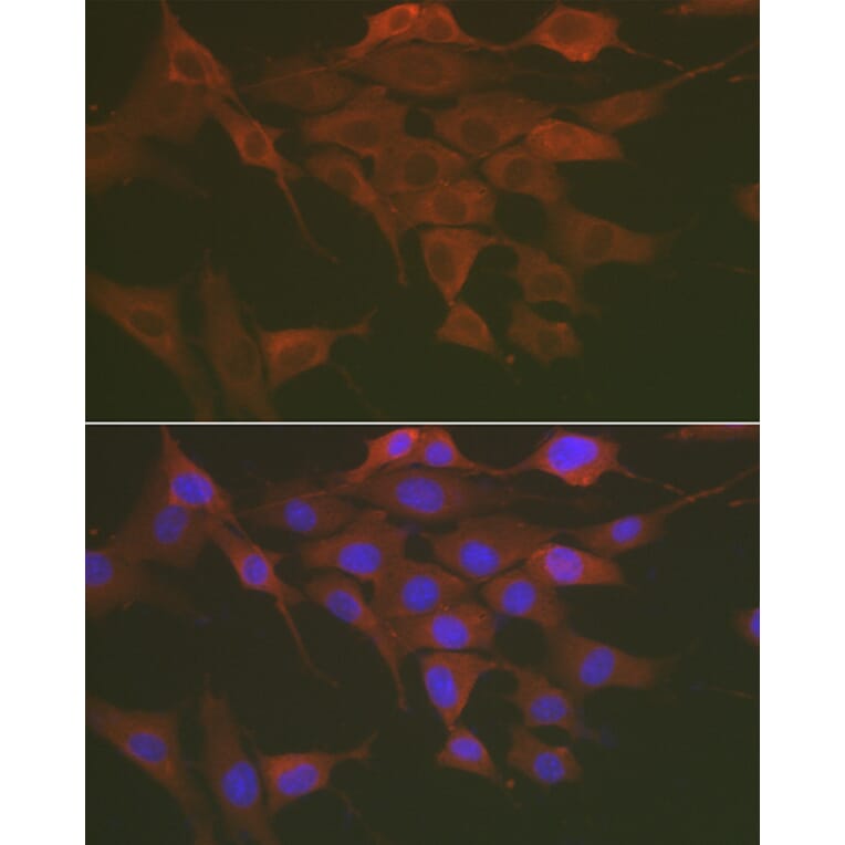 Immunofluorescence - Anti-NF-kB p65 Antibody (A80443) - Antibodies.com