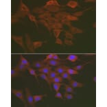 Immunofluorescence - Anti-NF-kB p65 Antibody (A80443) - Antibodies.com