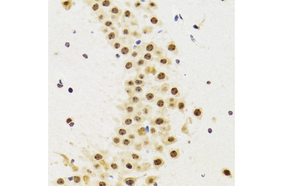 Immunohistochemistry - Anti-p53 Antibody (A80444) - Antibodies.com
