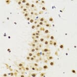 Immunohistochemistry - Anti-p53 Antibody (A80444) - Antibodies.com