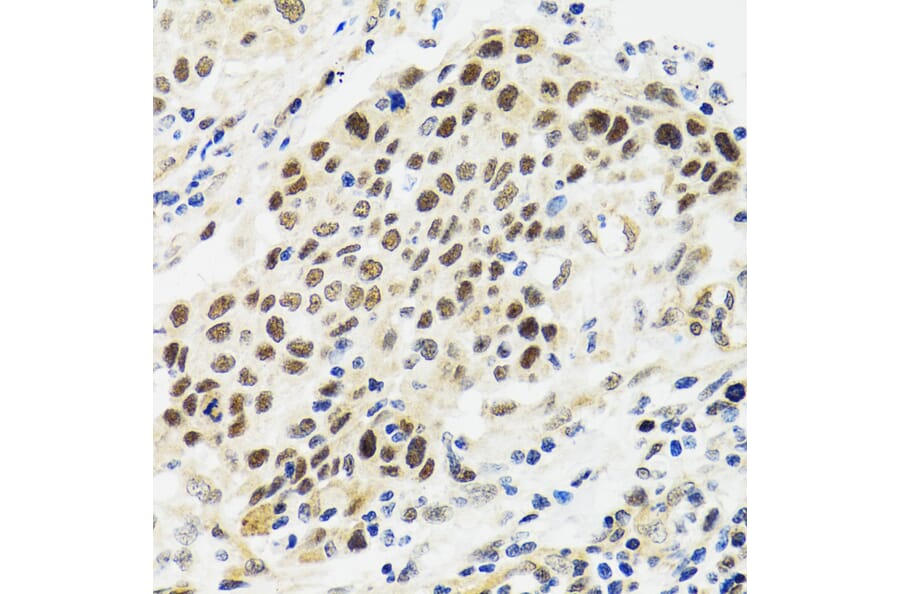 Immunohistochemistry - Anti-p53 Antibody (A80444) - Antibodies.com