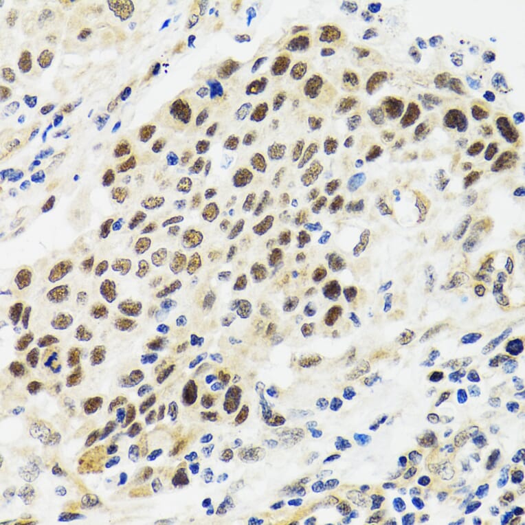 Immunohistochemistry - Anti-p53 Antibody (A80444) - Antibodies.com
