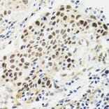 Immunohistochemistry - Anti-p53 Antibody (A80444) - Antibodies.com