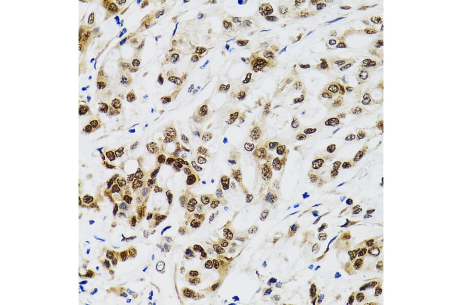 Immunohistochemistry - Anti-p53 Antibody (A80444) - Antibodies.com