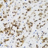 Immunohistochemistry - Anti-p53 Antibody (A80444) - Antibodies.com
