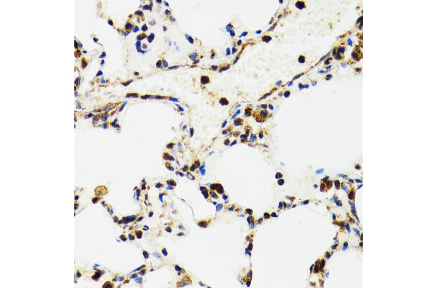 Immunohistochemistry - Anti-p53 Antibody (A80444) - Antibodies.com
