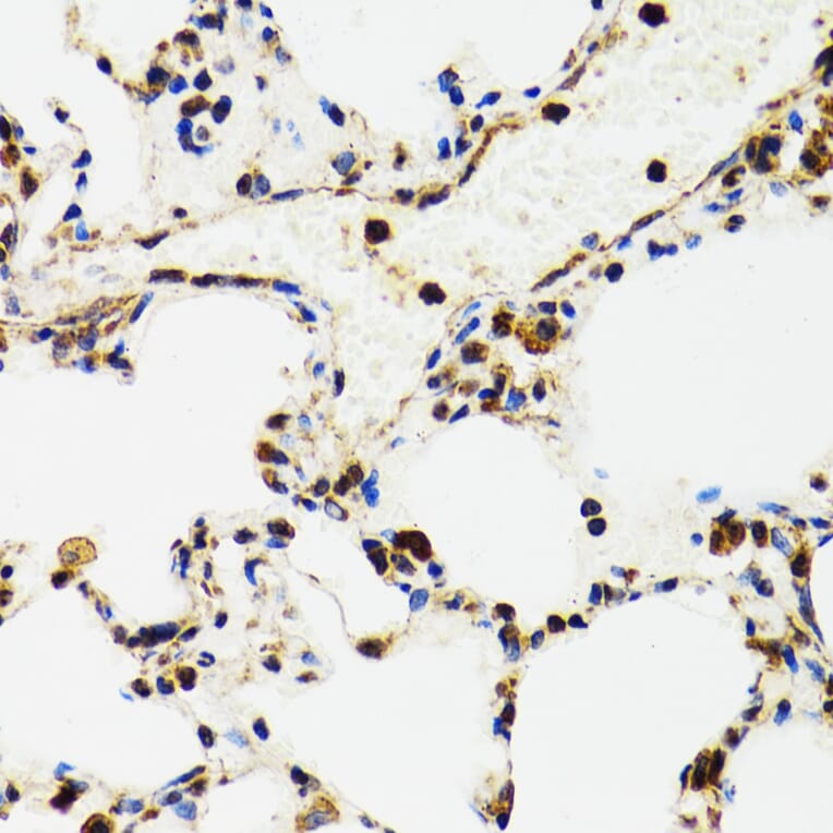 Immunohistochemistry - Anti-p53 Antibody (A80444) - Antibodies.com