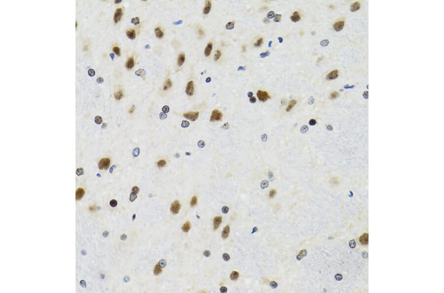 Immunohistochemistry - Anti-p53 Antibody (A80444) - Antibodies.com