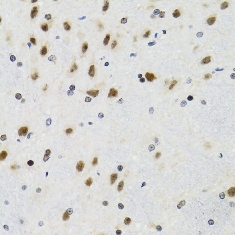 Immunohistochemistry - Anti-p53 Antibody (A80444) - Antibodies.com