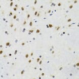 Immunohistochemistry - Anti-p53 Antibody (A80444) - Antibodies.com