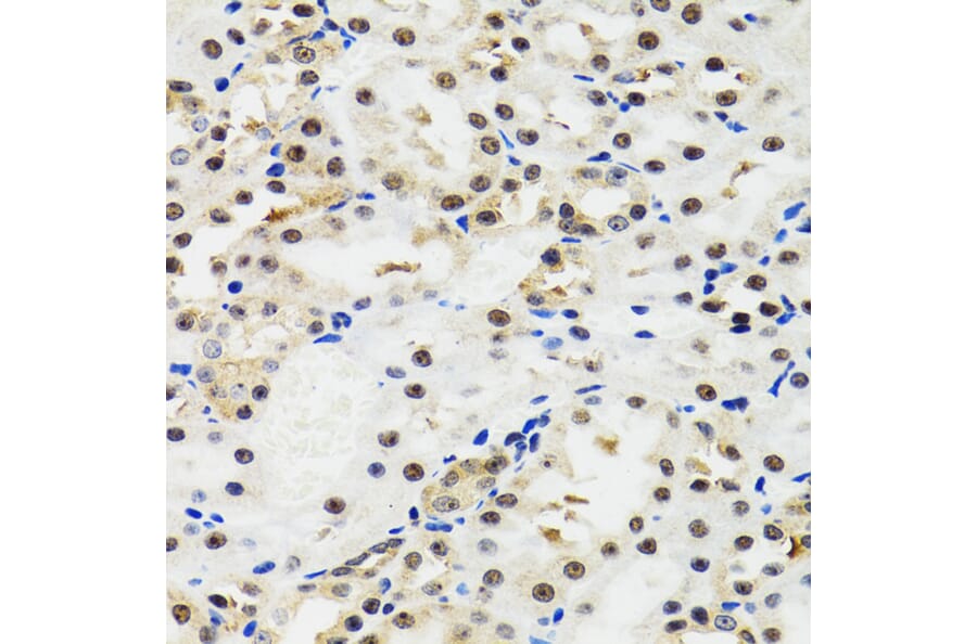 Immunohistochemistry - Anti-p53 Antibody (A80444) - Antibodies.com