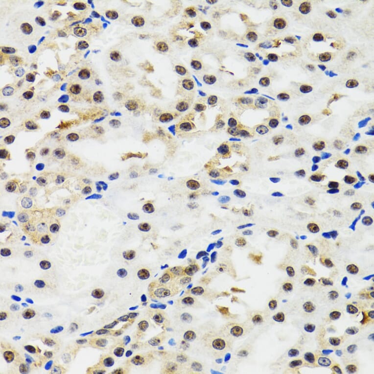 Immunohistochemistry - Anti-p53 Antibody (A80444) - Antibodies.com