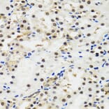Immunohistochemistry - Anti-p53 Antibody (A80444) - Antibodies.com