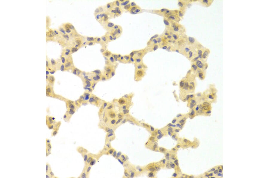Immunohistochemistry - Anti-IRF3 Antibody (A11373) - Antibodies.com