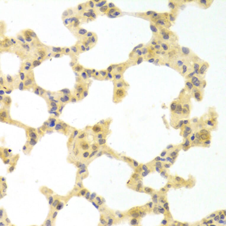 Immunohistochemistry - Anti-IRF3 Antibody (A11373) - Antibodies.com