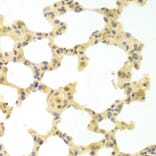Immunohistochemistry - Anti-IRF3 Antibody (A11373) - Antibodies.com