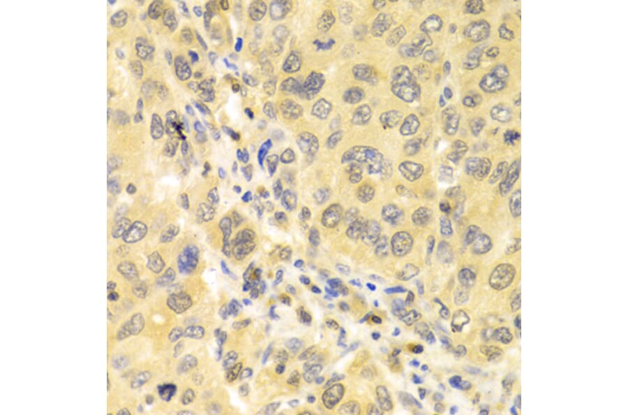 Immunohistochemistry - Anti-IRF3 Antibody (A11373) - Antibodies.com