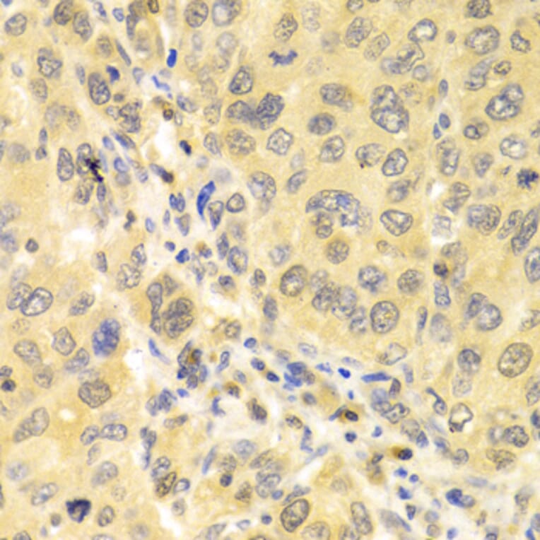 Immunohistochemistry - Anti-IRF3 Antibody (A11373) - Antibodies.com