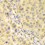 Immunohistochemistry - Anti-IRF3 Antibody (A11373) - Antibodies.com