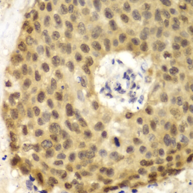 Immunohistochemistry - Anti-IRF3 Antibody (A11373) - Antibodies.com