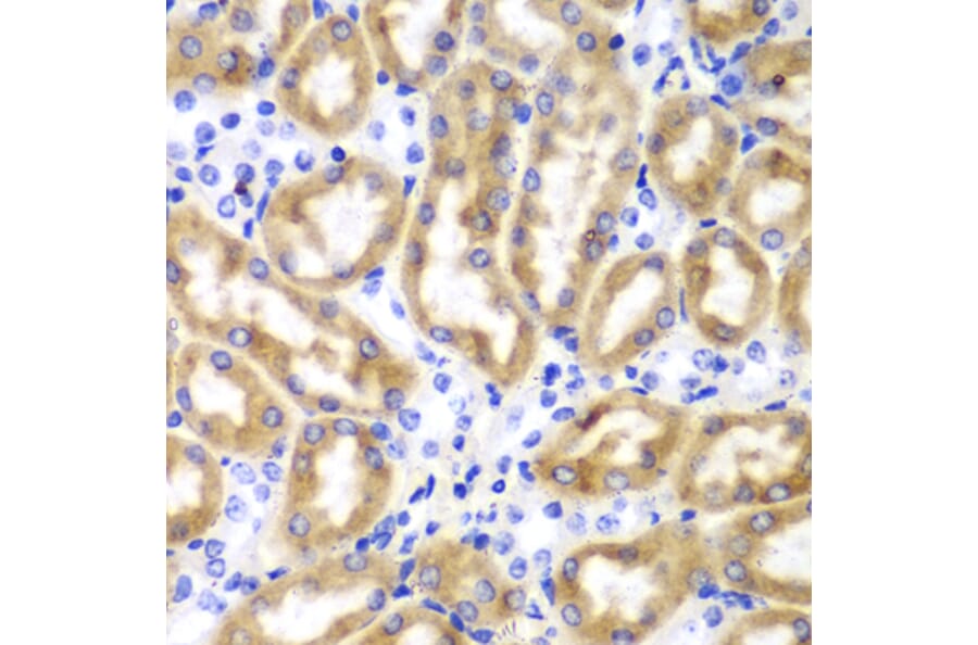 Immunohistochemistry - Anti-IRF3 Antibody (A11373) - Antibodies.com
