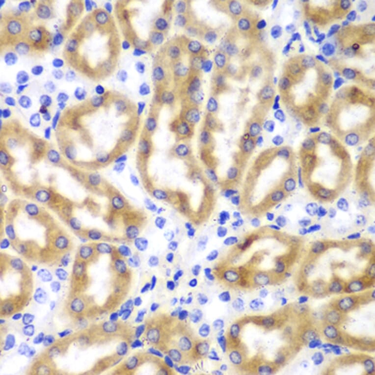 Immunohistochemistry - Anti-IRF3 Antibody (A11373) - Antibodies.com