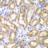 Immunohistochemistry - Anti-IRF3 Antibody (A11373) - Antibodies.com