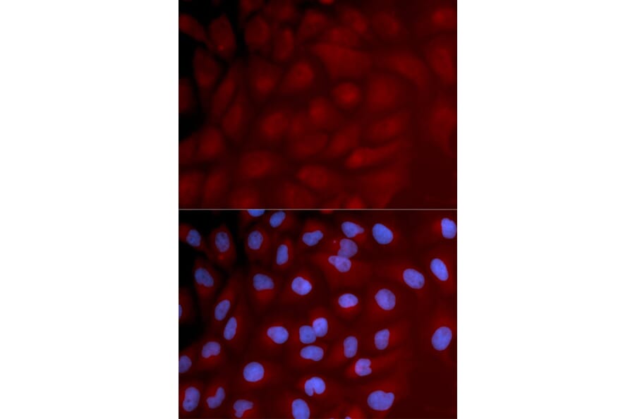Immunofluorescence - Anti-IRF3 Antibody (A11373) - Antibodies.com