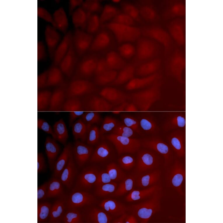 Immunofluorescence - Anti-IRF3 Antibody (A11373) - Antibodies.com