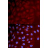 Immunofluorescence - Anti-IRF3 Antibody (A11373) - Antibodies.com