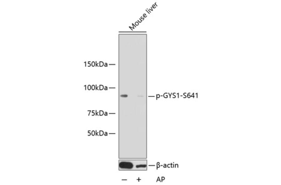 Western Blot - Anti-GYS1 (phospho S641) Antibody (AP0644) - Antibodies.com