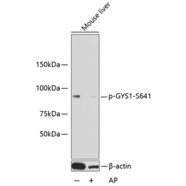 Western Blot - Anti-GYS1 (phospho S641) Antibody (AP0644) - Antibodies.com